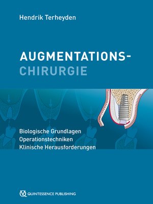 cover image of Augmentationschirurgie